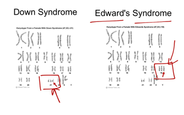 4 1b Genes Alleles And Heredity Educreations