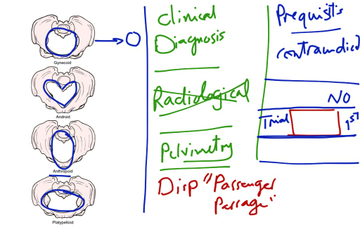 Contracted Pelvis | Educreations